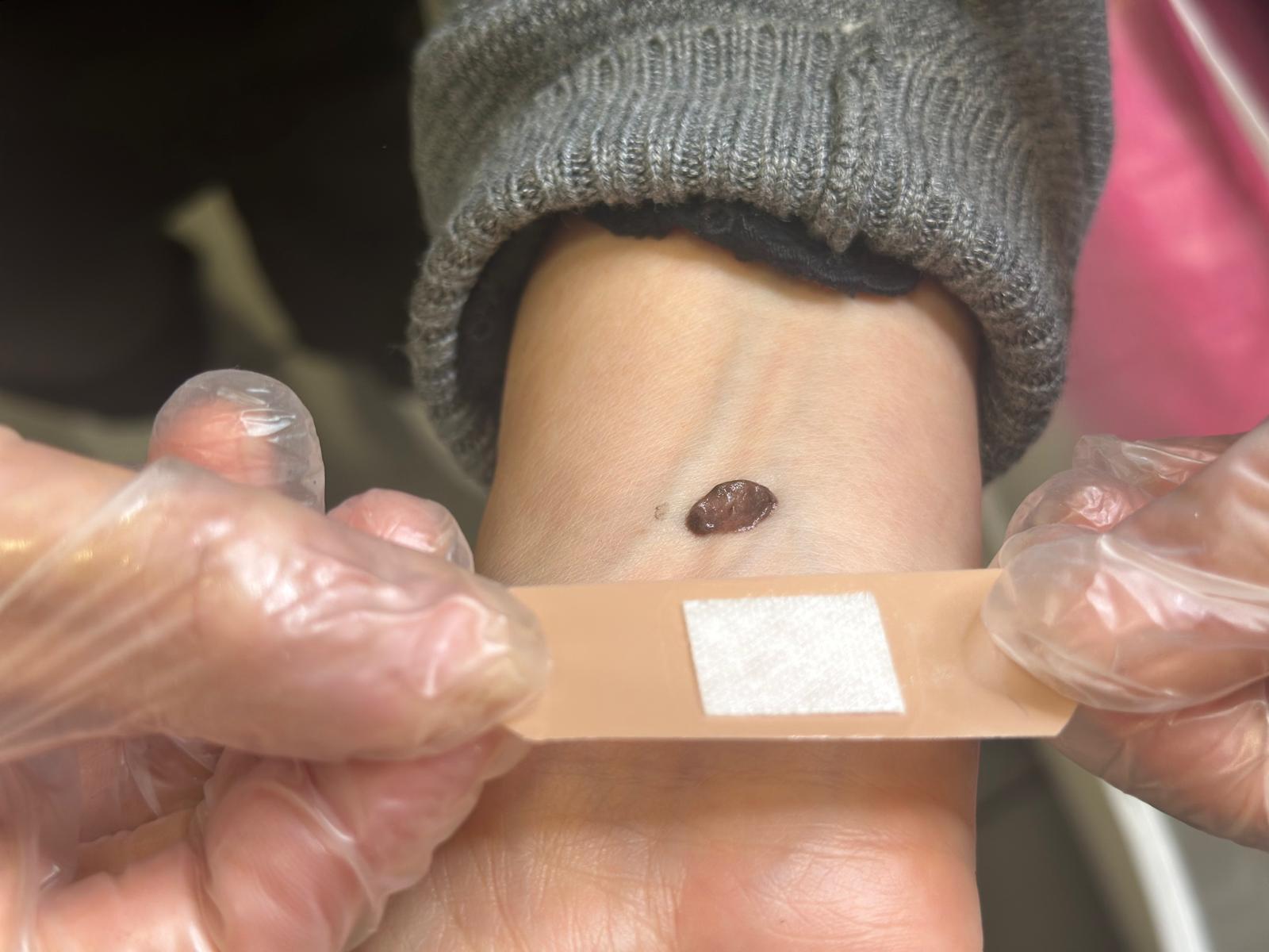 Step 0 - Patch Test