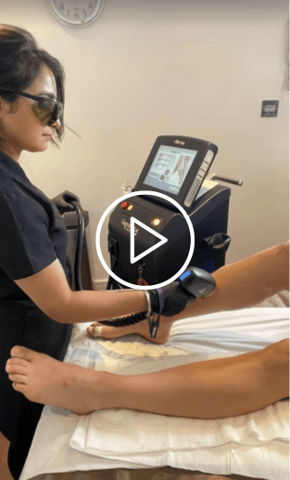 Soprano ICE Platinum handpiece giving full treatment coverage