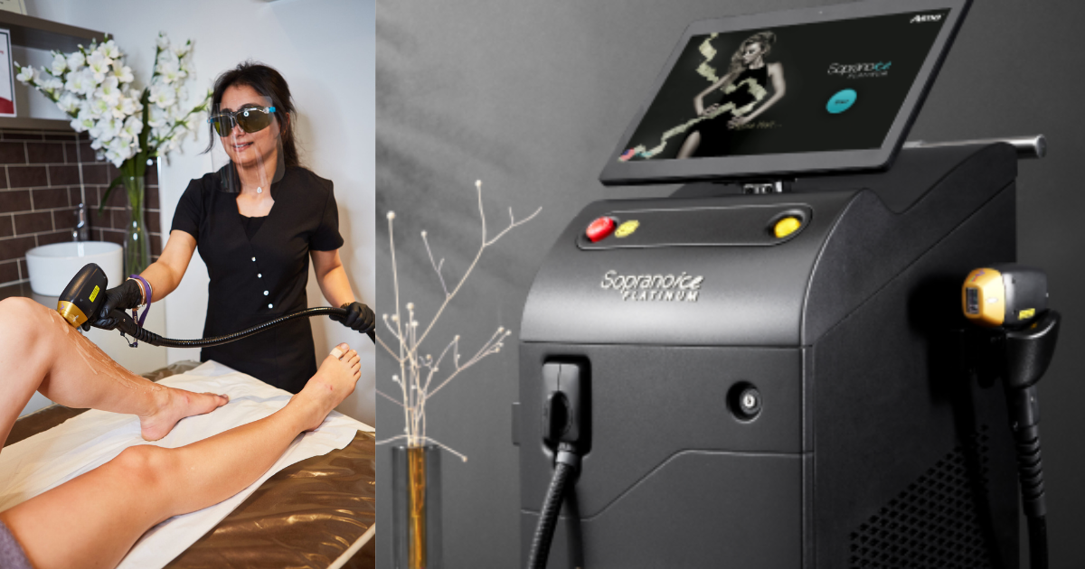 The Soprano ICE Platinum Laser Hair Removal System